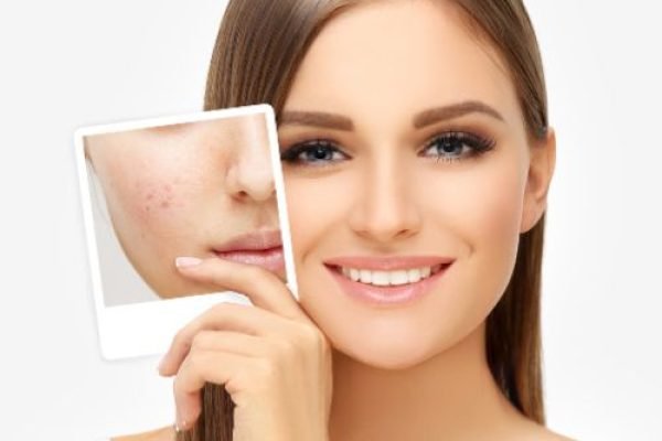 Dermal Therapy Courses Dermal Therapy Courses